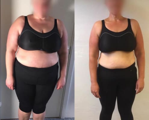 Vægttab før og efter kvinde, frontbillede